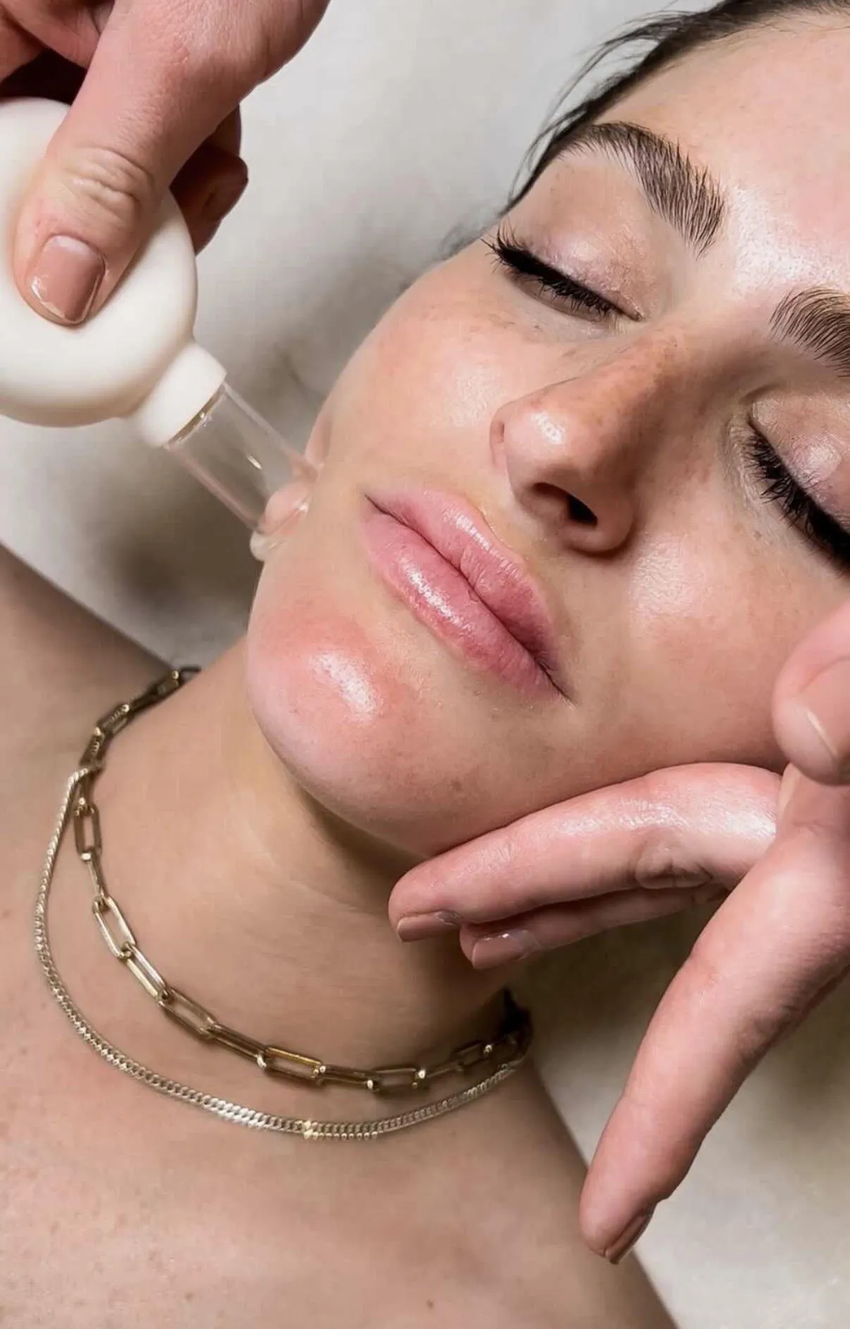Buccal massage and facial sculpting treatment